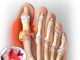 bẹnh-gout-kieng-an