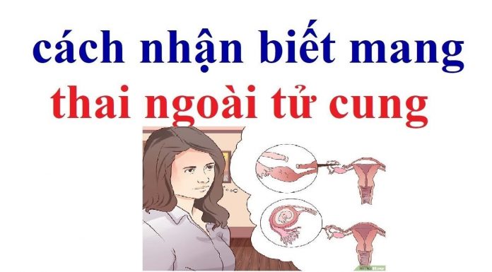 Mang thai ngoài tử cung? Tìm hiểu nguyên nhân và triệu chứng