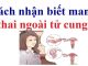 Mang thai ngoài tử cung? Tìm hiểu nguyên nhân và triệu chứng