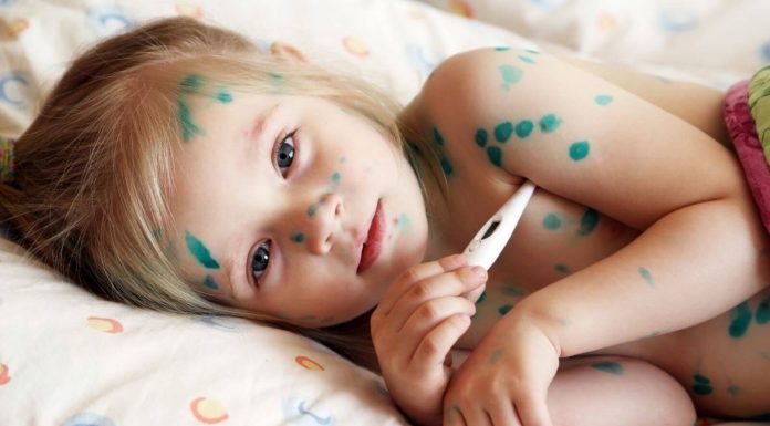 Những điều cần chú ý khi chăm sóc trẻ nhỏ bị bệnh thuỷ đậu be-bi-thuy-dau-2